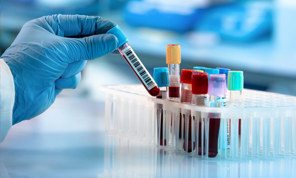 Cancer Breakthrough: Rapid Analysis of Blood Samples for Diagnostics