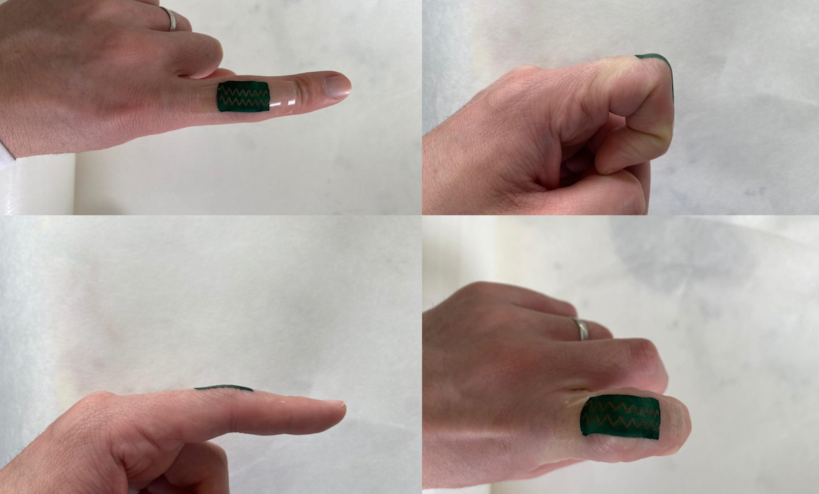 Impact - Technion scientists have created an electronic skin that can recognize the range of movement human joints normally make, with up to half a degree precision.