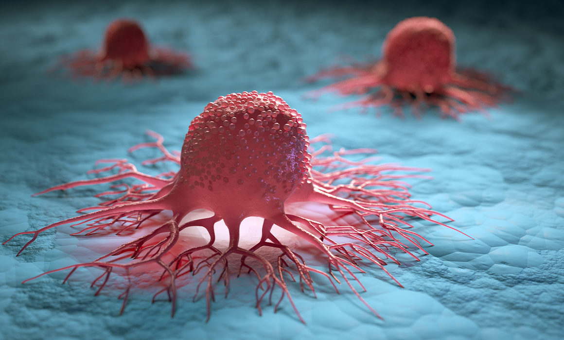 Technion Researchers Discover New Pathway for Attacking Cancer Cells