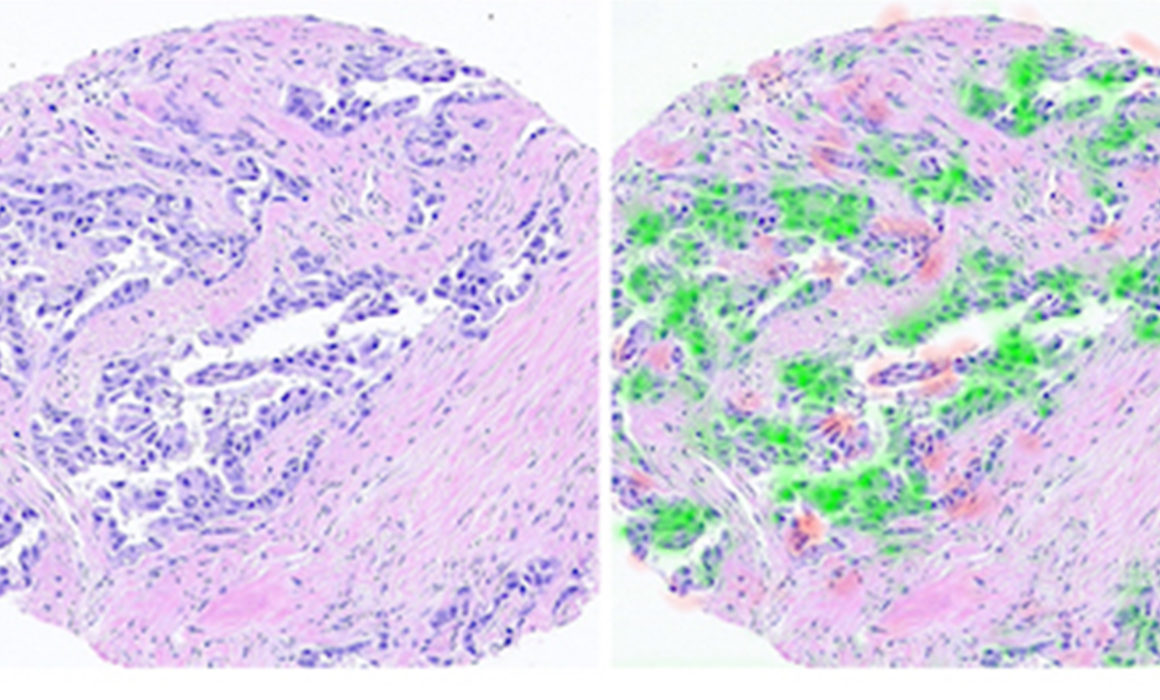 The AI Pathologist