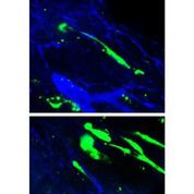 Growing Lymph Vessels in a Lab