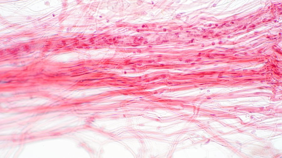 At the Technion, Prof. Shulamit Levenberg is 3D-printing cartilage structures from a patient's own cells to reconstruct underdeveloped ears, work that traces back to her postdoctoral research with tissue engineering pioneer Robert Langer at MIT.